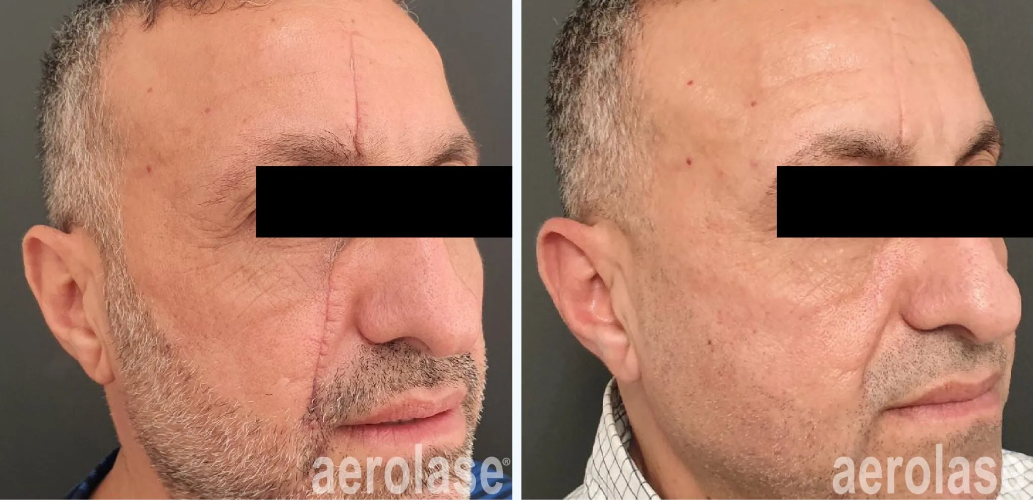 111traumatic-scar-watfa-before-and-after-2048x991